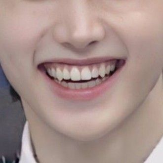 Natural Fangs Aesthetic, Fang Veneers, Teeth Claim, Natural Vampire Teeth, Sharp Canine Teeth Human, Natural Fangs Teeth, Teeth Side View, Teeth Fangs Natural, Natural Fangs