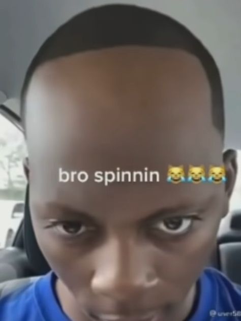 Ugly Haircut For Men, Messed Up Hairline, Bad Hairline, Ugly Hair, Picture Jokes, Bad Haircut, Receding Hairline, Hair Line, Goofy Pictures