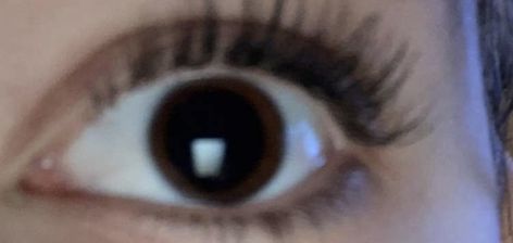 #pupil #eyes #acid Big Pupils Aesthetic, Big Pupils Eye, Big Pupils, Dilated Pupils, Eyes Aesthetic, Skin Aesthetics, Mha Oc, Eye Pictures, Curvy Fashionista