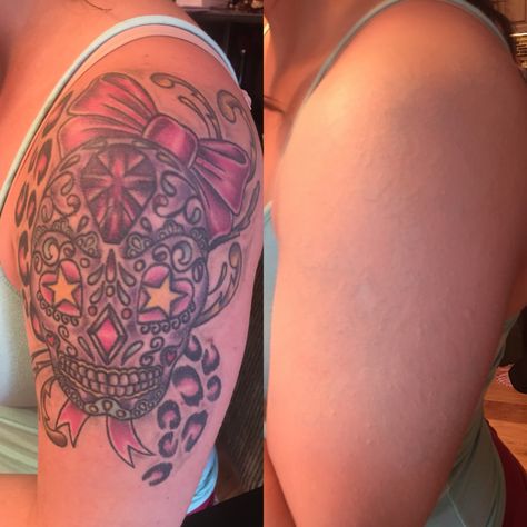 Tattoo Cover Up With Makeup, Covering Tattoos, Tattoo Coverups, Tattoo Makeup Coverup, Tattoo Coverup, Tattoo Makeup, Tattoo Skin, Tattoo Cover Up, Cover Fx