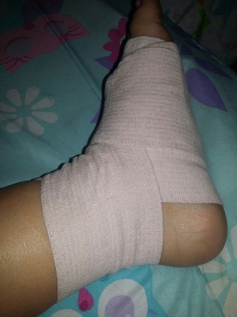 My foot😢😢😢😢😢😢 Ankle Injury Prank, Leg Accident Real Pic For Women, Leg Bandage Snap, Fake Injury Leg Snapchat, Leg Injured Images, Leg Swelling Snapchat, Leg Fracture Snapchat Story, Leg Fracture Photos, Ankle Injury Snapchat