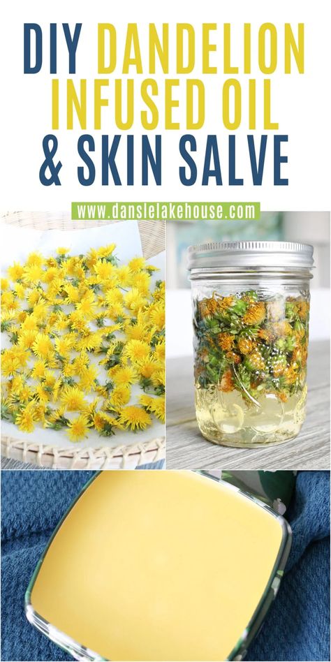 DIY Dandelion Infused Oil Skin Salve and Lip Salve. Looking for dandelion oil recipes or dandelion salve recipes? Learn how to make dandelion oil DIY - it's easy! Then use that dandelion oil to make a moisturizing dandelion salve. How to make dandelion salve recipes - dandelion salve uses. Useful dandelion recipes and dandelion uses for all natural skin care DIY. DIY salves and balms to make at home - great for sensitive skin. Skin salve essential oils - skin healing salve. DIY skin salve DIY. Dandelion Infused Oil, Diy Dandelion, Dandelion Salve, Dandelion Oil, Lip Salve, Herbal Medicine Recipes, Herbal Remedies Recipes, Foraging Recipes, Salve Recipes