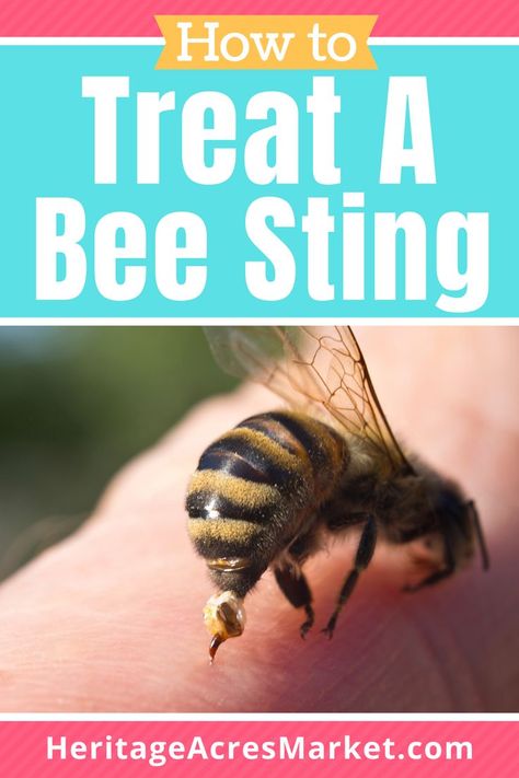 OUCH! You've just been stung by a bee. What should you do next? Bee Sting Swelling, Bee Sting Relief, Wasp Sting Remedy, Treating Bee Stings, Hornet Sting, Remedies For Bee Stings, Getting Rid Of Bees, Wasp Stings, Very Sleepy