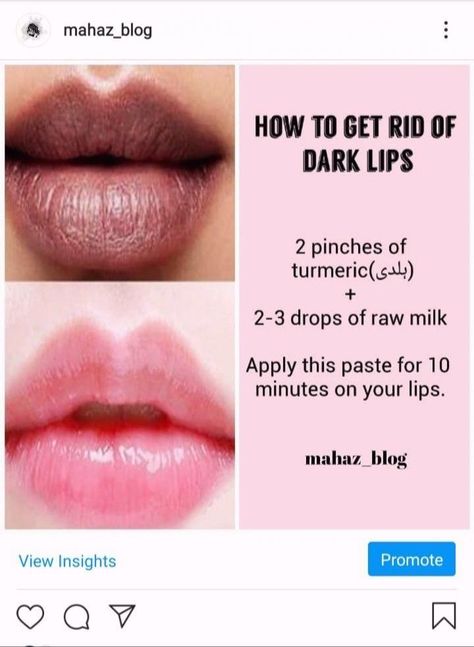 Lip Mask For Dark Lips, Tips For Dark Lips, How To Lighten Dark Lips Naturally, Lip Mask Homemade For Dark Lips, Lip Care For Dark Lips, Dark Lips Remedy Homemade, How To Lighten Lips, How To Lighten Dark Lips, Skin Pigmentation Remedies