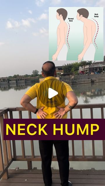 SUMIT NAGPAUL | YOGA & WELLNESS COACH | LUDHIANA on Instagram: "Try these 3 exercises for Neck Hump ✅ . Follow for more @samskaras_yoga  .  #neckexercise #neckexercises #shoulderworkout #shoulders #shoulderpain #shouldermobility #mobility #neckpainrelief #neckpaintreatment #painreliever #stiffneck #stiffness #neckhump #neck #cervical #cervicalpain #cervicalrelief" Exercises For Neck, Neck Hump, Cervical Pain, Neck Exercises, Posture Exercises, Yoga Wellness, Gym Workouts For Men, Stiff Neck, Neck Pain Relief