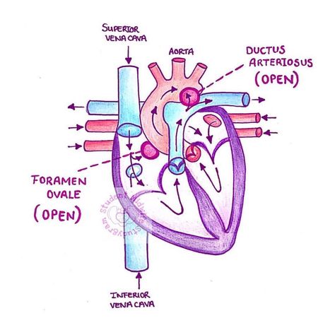 💕Student_Midwife_Studygram💕 on Instagram: “❤️ Fetal circulation differs from baby and adult due to 3️⃣ vascular shunts, 2️⃣ of which are located in the heart!❤️ 🌟 Foramen ovale - in…” Fetal Circulation, Ob Ultrasound, Peds Nursing, Anatomy Books, Cardiac Anatomy, Obstetric Ultrasound, Student Midwife, Nursing Mnemonics, Neonatal Nurse