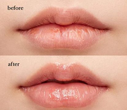 Lip Mask with Shea Butter Melting Balm, Lip Repair, Korean Lips, Amazon Beauty, Cracked Lips, Lip Butter, Amazon Beauty Products, Lip Mask, God Illustrations