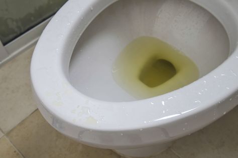 What the Color of Your Pee Means http://greatist.com/live/what-the-color-of-your-pee-means Creative Backyard, Bad Carbohydrates, Sugar Detox, Healthy Eating Habits, Health And Fitness Tips, Health Facts, Healthy Living Lifestyle, Health Diet, Backyard Ideas