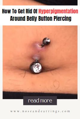 How To Get Rid Of Hyperpigmentation Around Belly Button Piercing Get Rid Of Piercing Bumps, Rejecting Belly Button Piercing, Infected Belly Piercing, Infected Belly Button, Belly Button Piercing Aftercare, Ear Piercing Bump How To Get Rid, Getting Rid Of Scars, Scar Cover Up, Bellybutton Piercings