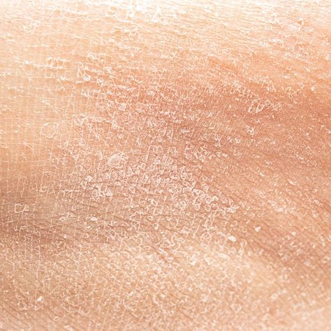 Photo dry human skin of a woman leg conc... | Premium Photo #Freepik #photo #moisture #dry-skin #hand-cream #body-cream Skin Photo, Women Legs, The Skin, Premium Photo, Dry Skin, A Woman, Moisturizer, Stock Photos, Human