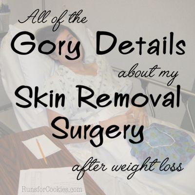 Excess Skin Removal Surgery, Thigh Lift Surgery Before And After, Lower Body Lift Surgery Before And After, Skin Removal Surgery Before And After, Lower Body Lift Surgery, Panniculectomy Before And After, Loose Skin Surgery, Mommy Makeover Surgery Recovery, Arm Lift Surgery