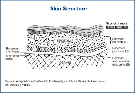 Epidermolysis Bullosa, Basement Membrane, Skin Anatomy, Anatomy Images, Dummies Book, Skin Grafting, Skin Structure, Thick Skin, Rare Disease