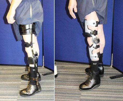 Cumbersome NHS leg calliper vs. lightweight carbon fibre knee brace from Technology in Motion Aesthetic Mobility Aid, Orthotics And Prosthetics, Braces Girls, Health Goth, Leg Braces, Body Pose Drawing, Mobility Aids, Human Poses Reference, Sketches Simple