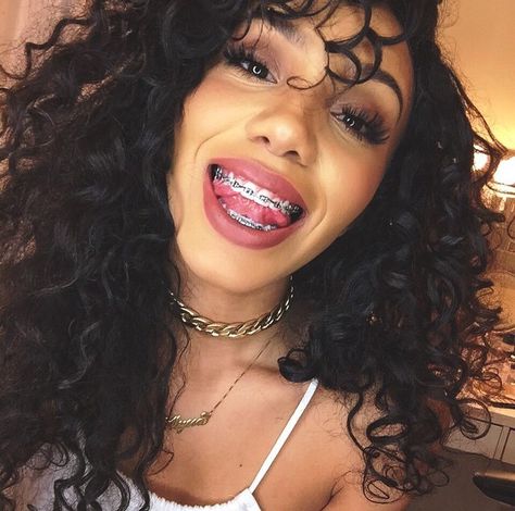 @foreverflawlyss  Be a beautiful & confident braceface ! #BeautifulBraceface #BracefaceGoals ! Cute Braces Colors, Braces Tips, Getting Braces, Braces Girls, Cute Braces, Brace Face, Braces Colors, Dental Braces