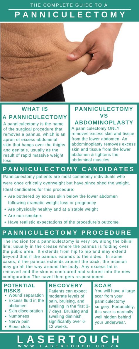 #Lasertouch #CosmeticSurgery #weightloss #excessskin #excessskinremoval #panniculectomy Excess Skin Removal Surgery, Panniculectomy Recovery, Panniculectomy Before And After, Panniculectomy Surgery, Loose Skin Surgery, Body Lift Surgery, Surgery Prep, Healthy 2024, Tummy Tucks Recovery