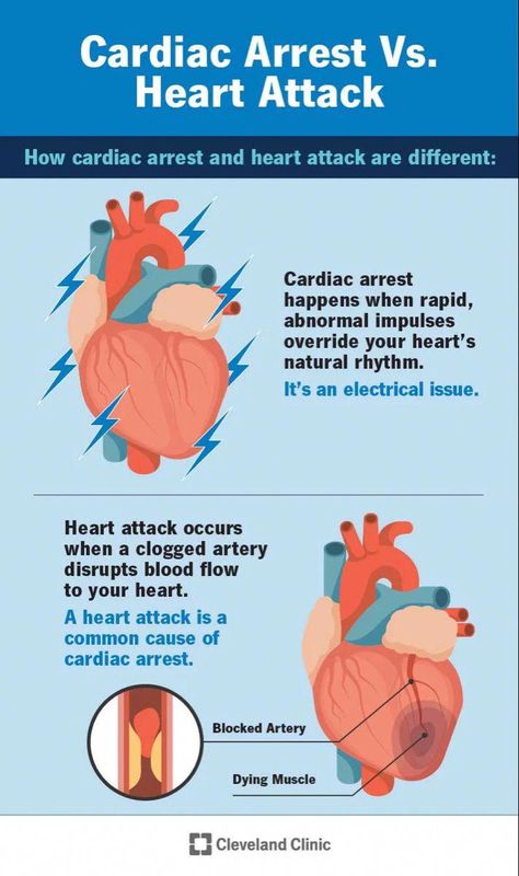 Both a heart attack and cardiac arrest can be scary and life-threatening medical conditions affecting your heart, but there are differences in how and why they occur. #HealthAndWellnessTips Summer Health, Congenital Heart Defect, Doctor Advice, Health And Fitness Magazine, Home Doctor, Healthy Diet Tips, Cleveland Clinic, Heart Problems, Daily Health Tips