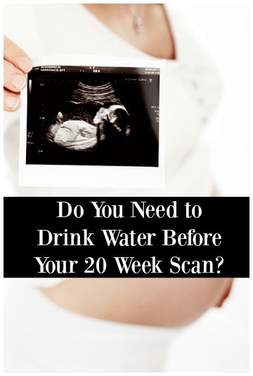 Do You Need to Drink Water Before Your 20 Week Scan? 20 Week Ultrasound, Second Trimester Workouts, 20 Week Scan, Second Trimester, Trimesters Of Pregnancy, First Trimester, Ultrasound, Drinking Water, Do You Need