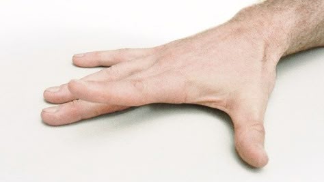 7 Hand Exercises to Ease Arthritis Pain Hand Therapy Exercises, Arthritic Pain, Finger Exercises, Therapy Exercises, Trigger Finger, Hand Exercises, Hand Pain, Knee Exercises, Knee Pain Relief