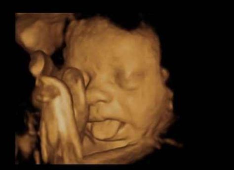 The Raspberry | 10 Surprising Ultrasound Photos Of Babies With A Sense Of Humor 4d Ultrasound Pictures, 3d Ultrasound Pictures, 3d Ultrasound, 4d Ultrasound, Fetal Doppler, Saving For Baby, Baby Ultrasound, Ultrasound Pictures, Unborn Baby