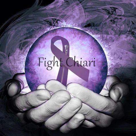 September is Chiari Malformation Awareness Month. Chari Malformation, Chiari Warrior, Osgood Schlatter Disease, Warrior Wallpaper, Dog Skull, Chiari Malformation, Waterslide Decal Paper, Cerebrospinal Fluid, Brain Surgery