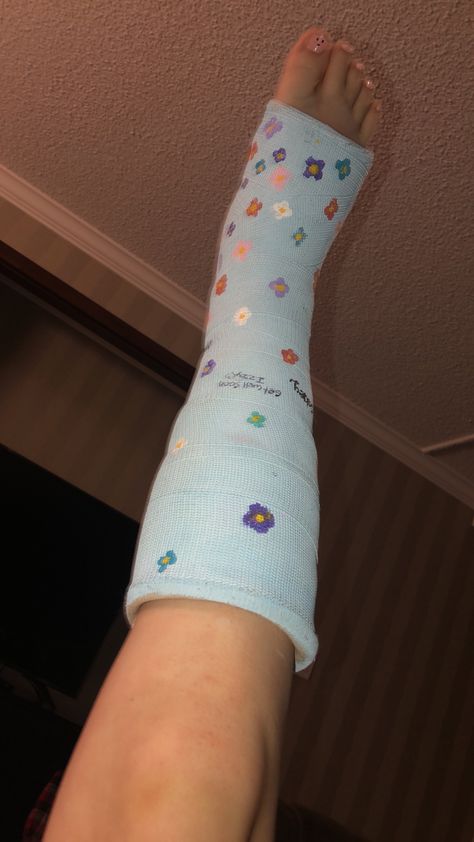 A leg cast going below my knee, with a light baby blue Color with purple, blue ,turquoises,white, maroon flower with a dot in the middle of each one coloured yellow some bright yellow other more of a mustard Color ! Cute Leg, Leg Cast, Middle School Outfits, Cute Flowers, Q Tip, Match Me, School Outfits, Acrylic Paint, Middle School