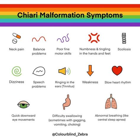 Chiari Malformation Quotes, Chiari Malformation Type 1, Chiari Malformation Surgery, Chiari Malformation Awareness, Autonomic Nervous System Dysfunction, Medical Things, Forward Head Posture Exercises, Medical Diagnosis, Neck And Shoulder Muscles