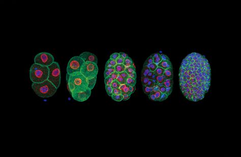 Stages of C. elegans (small round worm) development | 2017 Photomicrography Competition | Nikon’s Small World C Elegans, Microscope Art, Science Artwork, Nikon Small World, Microscopic Photography, Under The Microscope, Growth And Decay, Electron Microscope, Photography Contest