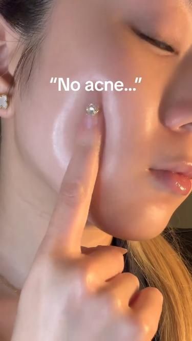 Ácido Mandélico para acne e manchas — como usar? Clear Skin Routine, Acne Dark Spots, Good Skin Tips, Sheet Masks, Top Skin Care Products, Professional Skin Care Products, Facial Skin Care Routine, Skin Care Order, Mascara Facial