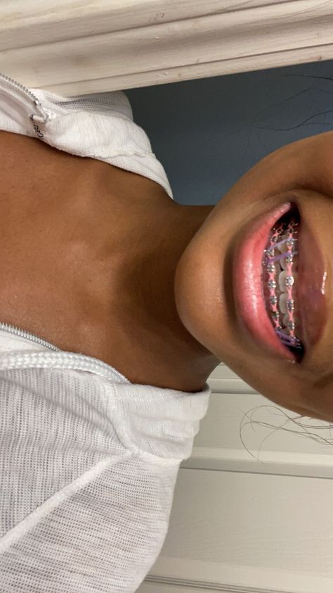 Pink braces black girls Black Powerchain Braces Colors, Braces Ideas Cute, Braces Colors On Black Women, Hot Pink Power Chain Braces, All Black Outfit With Pink Accessories, Braces Vision Board, Braces Black Bands, Pretty Girl Braces, Braces Colors With Rubber Bands