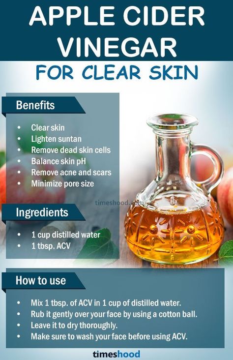 Get Clear Skin Naturally, For Clear And Glowing Skin, Apple Cider Vinegar Remedies, Clear And Glowing Skin, Apple Cider Vinegar For Skin, Benefits Of Apple Cider Vinegar, Clear Skin Naturally, Benefits Of Apple Cider, Benefits Of Apple