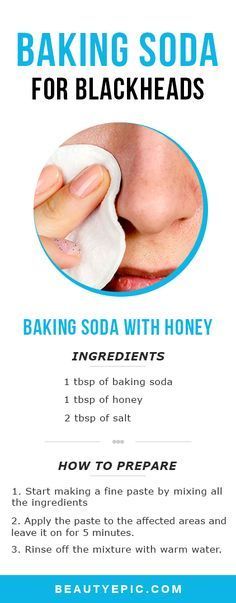 Baking Soda for Blackheads: Try These Effective Home Remedies Baking Soda For Blackheads, Baking Soda For Face, For Blackheads, Seni Dan Kraf, Clear Pores, Baking Soda Shampoo, Makeup Hacks, Beauty Remedies, Skin Remedies