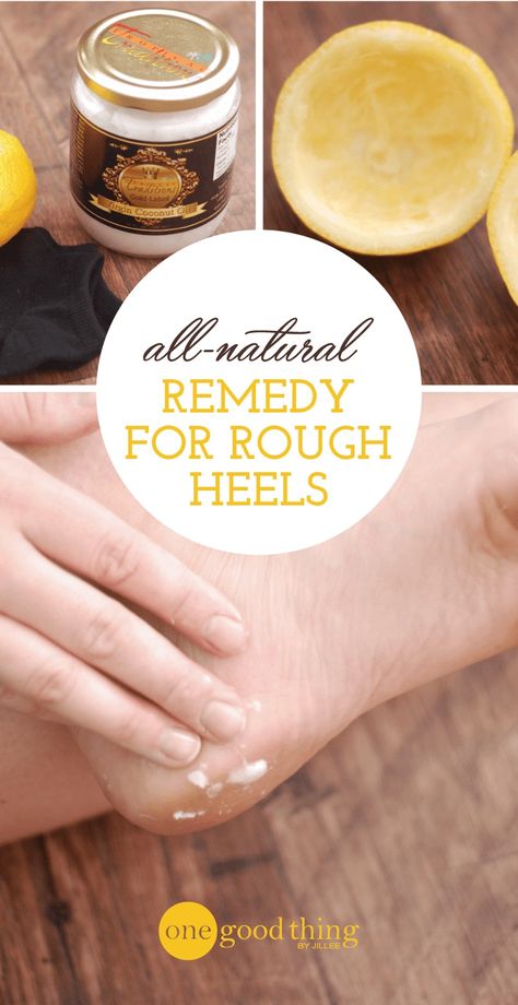 Cracked Heel Remedies, Listerine Foot Soak, Dry Heels, One Good Thing By Jillee, Natural Beauty Remedies, Rough Heels, Foot Soak, Cracked Heels, Foot Bath