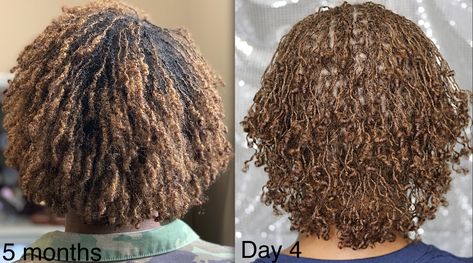 Sisterlocks Vs Microlocks, Microloc Progress, Micro Locs Vs Sister Locs, Short Sisterlocks, Adult Hairstyles, Microloc Journey, Micro Locks, Locks Styles, Loc Method Natural Hair