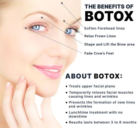 The transformative benefits of Botox and enhance your natural beauty. What are the benefits of Botox? Find out! - #AdvantagesofBotoxprocedures #BenefitsofBotoxinjections #Botoxadvantages #Botoxadvantagesforappearance #Botoxbenefitsforskin #Botoxcosmeticbenefits #Botoxtherapyperks #Botoxtreatmentbenefits #PositiveeffectsofBotox #WhychooseBotox Botox Benefits, Aesthetic Nursing, Aesthetics Business, Botox Injection, Cheek Lift, Face Fillers, Aesthetic Nurse, Botox Face, Thread Lift