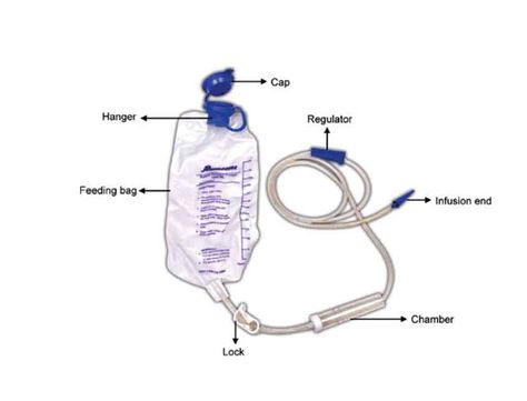 Urine bag (urinary drainage bag) is a medical-grade PVC bag attached to a urinary catheter used to collect and store urine temporarily after draining the urine through the catheter. It is used to treat people with health challenges that affect the urine flow, such as urinary incontinence, urinary retention, surgery that requires the catheter. In ... Read more Belly Bag, Health Challenges, Pvc Bag, Urinary Tract, Treat People, Health Challenge, Rubbing Alcohol, Surgery, Medical