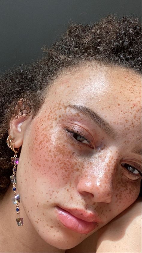 Full Face Freckles, Glass Skin Freckles, Freckles All Over Face, Glass Skin With Freckles, Clear Skin With Freckles Aethstetic, Beauty Marks Aesthetic, Bare Face Aesthetic, Freckles On Face, Natural Beauty Aesthetic