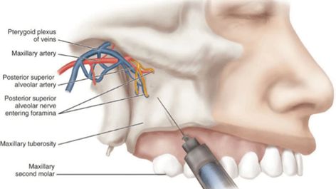 Anatomy Head, Dental Hygienist School, Dental Quotes, Registered Dental Hygienist, Dental Images, Dental Hygiene School, Dentistry Student, Dental Anatomy, Dental Life