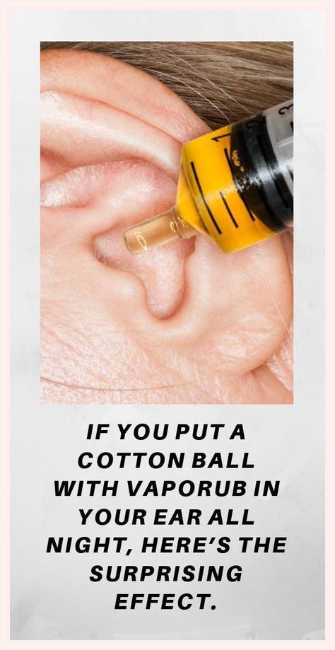 By Putting A Cotton Ball Of VapoRub In Ear All Night See What Will Happen.. Vaporub Uses, Ear Seeds, Vicks Vaporub Uses, Uses For Vicks, Cleaning Your Ears, Sinus Headache, Vicks Vaporub, Eucalyptus Oil, Muscle Aches