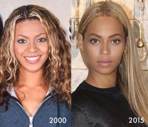 Beyonce Nose Job, Nose Plastic Surgery, Bad Plastic Surgeries, Breast Image, Celebs Without Makeup, Rhinoplasty Surgery, Facial Plastic Surgery, Celebrity Plastic Surgery, Dental Cosmetics