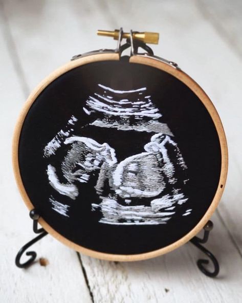 Ultrasound Embroidery by Yulia Sherbak Sound Picture, Baby Ultrasound, Modern Embroidery Kit, Embroidery Hoop Crafts, Embroidered Portrait, Ultrasound Pictures, Special Pictures, Hand Embroidery Projects, Thread Painting