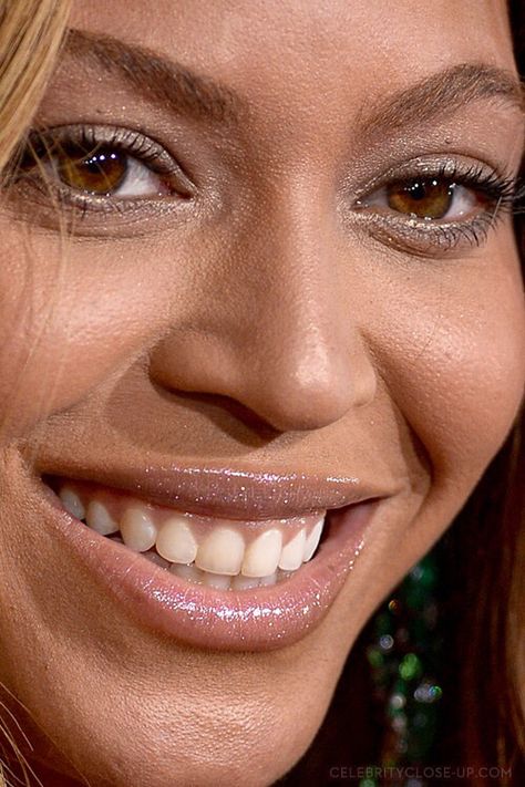 Celebrity closeup Beyonce Nose Job, Beyonce Eyes, Glossy Lips Makeup, Bad Skin, Bad Teeth, Brown Eyed Girls, Nose Job, Glamour Makeup, Beyonce Knowles