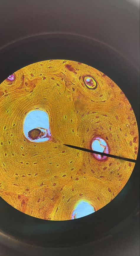 Bone Under Microscope, Human Cells Under Microscope, Cell Specialization, Cells Under Microscope, Bone Cells, Microscope Pictures, Biology Experiments, Under Microscope, Microscopic Photography