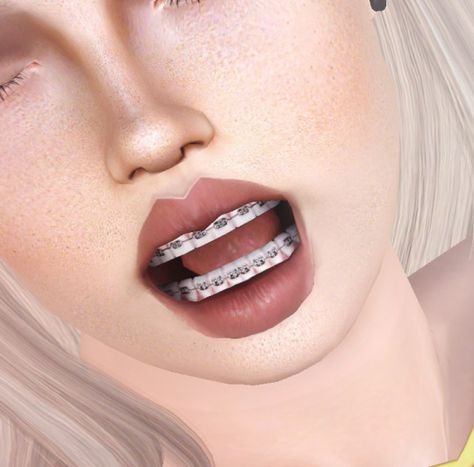 DescargasSims Sims 4 Cc Teeth Jewelry, Braces Cc Sims 4, Sims 4 Colored Braces, The Sims 4 Cc Braces, Cc Teeth Sims 4, Sims 4 Cc Braces Teeth, Sims 4 Teeth Cc Braces, Sims Cc Piercings, Sims Teeth Cc