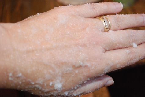 Home recipe for dry, chapped hands. You probably have everything you need already at home. People can't beiieve it when I tell them what to do, but then LOVE IT WHEN IT WORKS! Dry Hands Remedy, Chapped Hands, Dry Skin Remedies, Diy Kosmetik, Beauty Remedies, Dry Skin Care, Skin Remedies, Beauty Recipe, Diy Skin