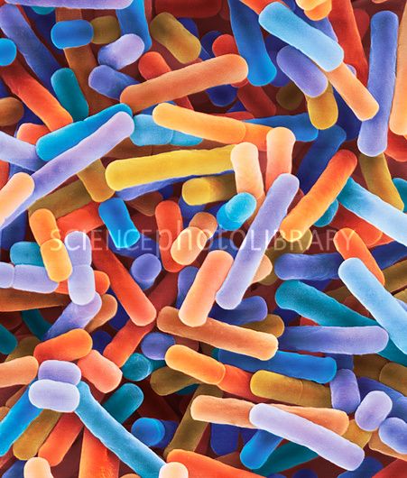 Lactobacillus bulgaricus yogurt bacterium, SEM Yogurt, Color