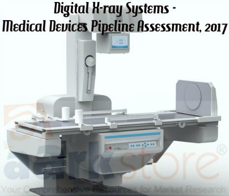 Digital X-ray Systems - Medical Devices Pipeline Assessment, 2017 X Ray Machine, Xray Machine, Futuristic Designs, Medical Imaging, Niche Marketing, Research Report, Medical Device, Radiology, New Engine