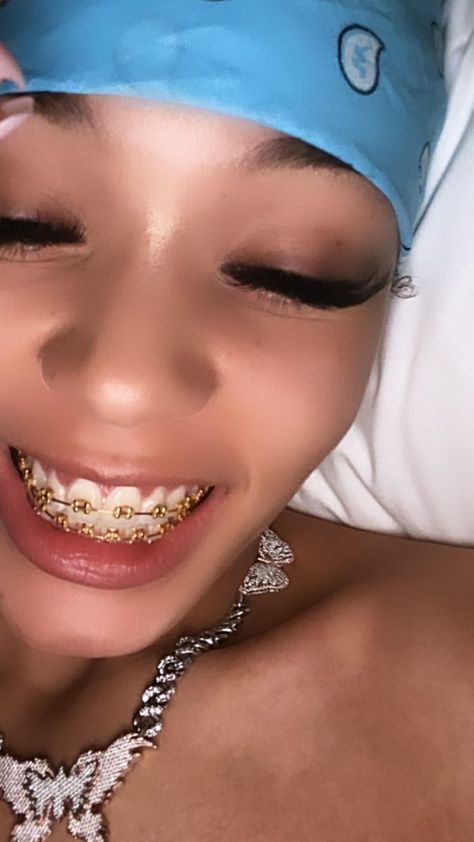 Power Chain Braces, Gold Braces, Cute Braces Colors, Pretty Teeth, Braces Tips, Braces Girls, Cute Braces, Clear Braces, Brace Face