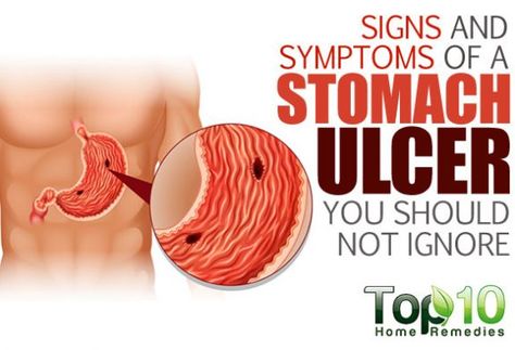 Home Remedy For Ulcers Stomach, Stomach Cramps Causes, Food For Stomach Ulcers, Stomach Ulcers Symptoms, Ulcer Symptoms, Ulcer Diet, Stomach Remedies, Top 10 Home Remedies, Stomach Ulcers