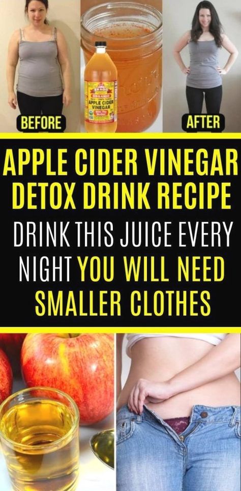 Apple Cider Detox, Apple Cider Vinegar Detox Drink, Veggie Juice, Apple Cider Vinegar Detox, Body Detoxification, Apple Cider Vinegar Drink, Natural Detox Drinks, Organic Apple Cider Vinegar, Detox Drinks Recipes