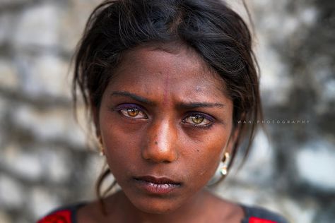 The Gypsy Girl with two different eye colors | by Thanwan Singh Two Different Eye Colors, Pushkar Mela, Heterochromia Iridum, Different Eye Colors, Heterochromia Eyes, Bald Women, Unique Faces, Magic Eyes, Aesthetic People